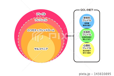 フレイル ロコモティブシンドローム サルコペニア フレイル ロコモティブシンドローム サルコペニア 143810895