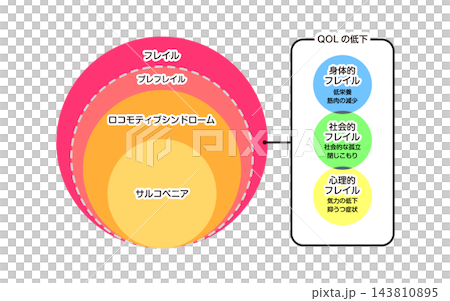 フレイル ロコモティブシンドローム サルコペニア フレイル ロコモティブシンドローム サルコペニア 143810895
