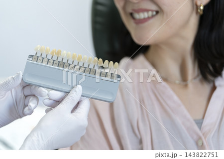 シェードガイドで患者と歯の色を確認する歯科技工士の手元 143822751