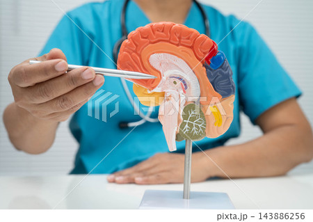 Alzheimer disease, Asian doctor holding brain anatomy model for study diagnosis and treatment in hospital. 143886256