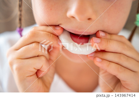 A girl uses both hands to position a dental mouthguard in her mouth. Inserting the appliance is a step in a teeth grinding care routine. A girl uses both hands to position a dental mouthguard in her mouth. Inserting the appliance is a step in a teeth grinding care routine. 143967414