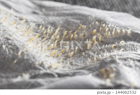 Macro view of extracted sebum plugs and dead skin cells on used white cleansing strip, displaying results of pore purification and skin hygiene routine 144002532
