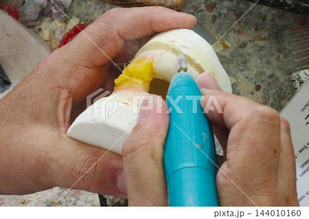 dental laboratory dental prostheses dental laboratory dental prostheses 144010160