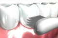 3DCGデンタル01 1654907